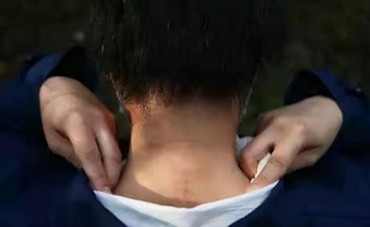 2016年八达岭老虎咬人案：母亲虎口救女儿身亡，女儿因毁容无工作