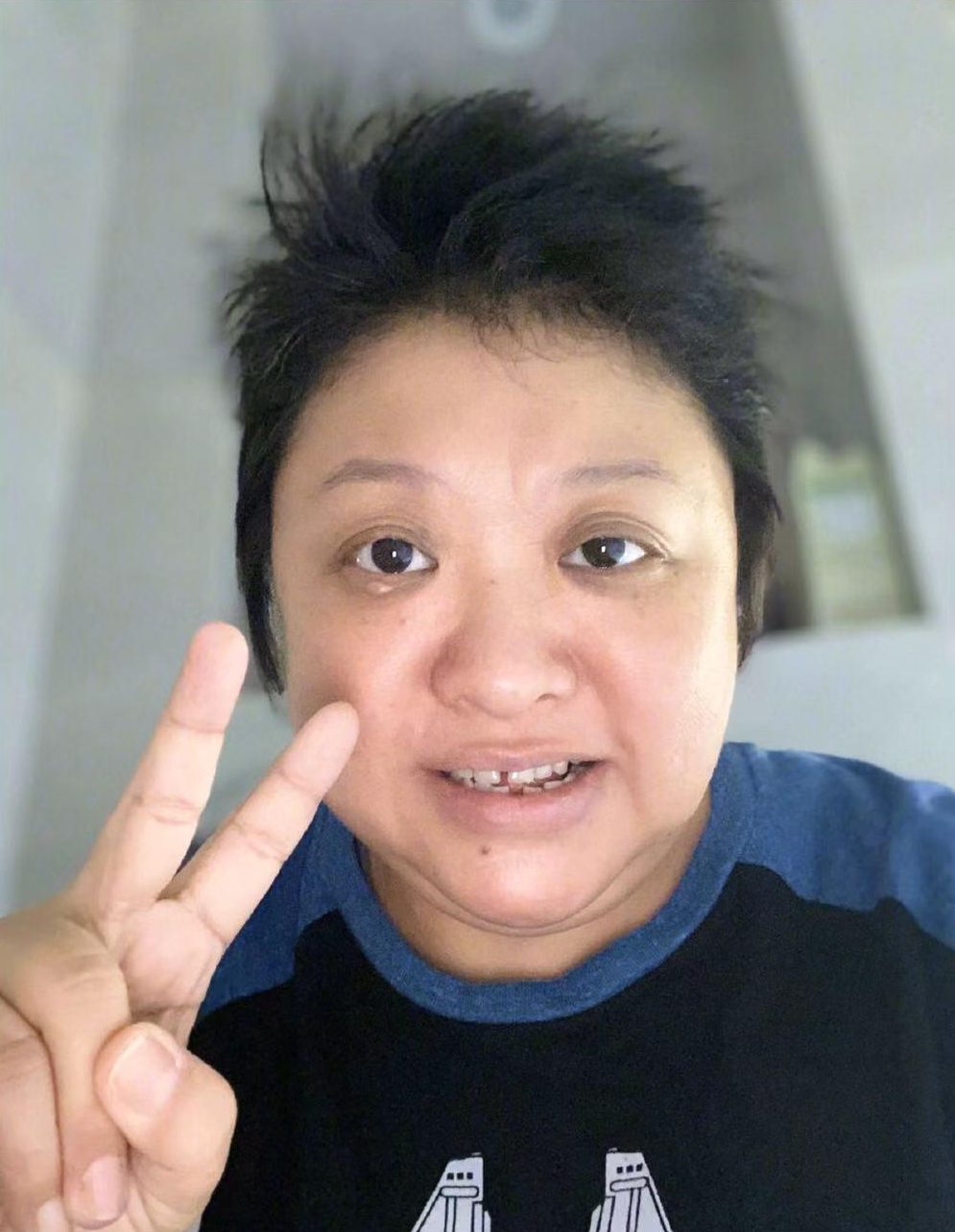 韩红怎么了?暴瘦,缺多颗牙,眼睛肿胀,戴廉价手表,让人不敢认