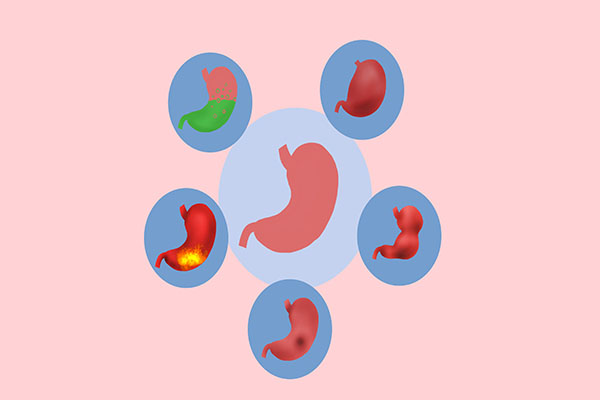 胃炎到胃癌，往往只需要4步？做好3件事，学会“善待”你的胃