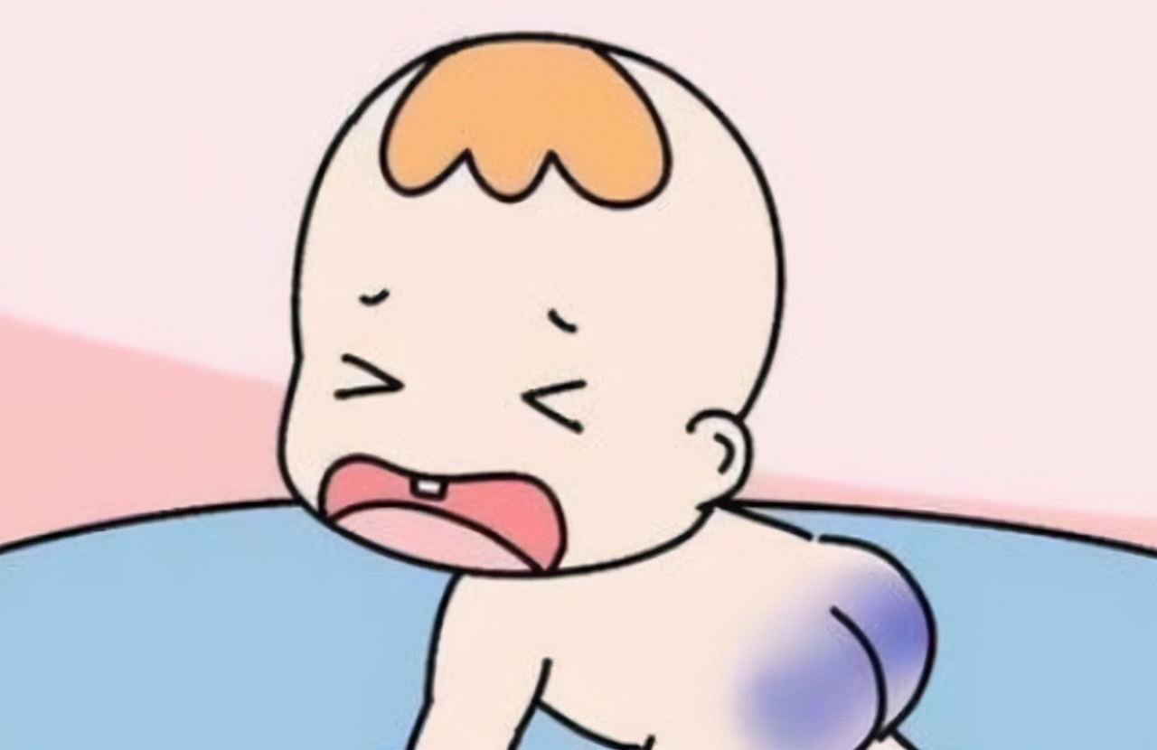 新生儿屁股的"淤青"是怎么弄的?不是投胎时被踢,或与亲人有关