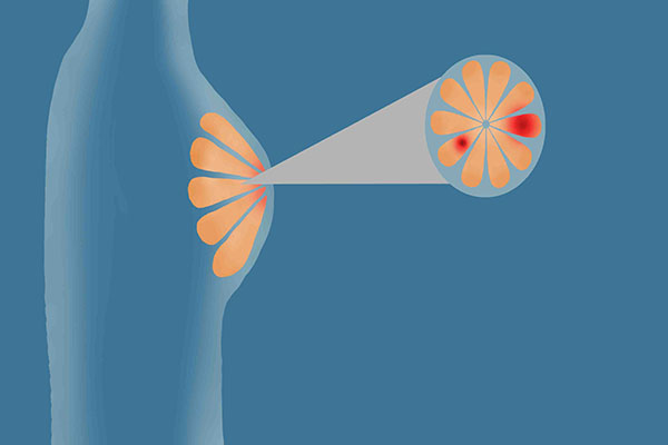 什么时候检查乳腺B超比较好？错过时机或影响结果，提前了解下