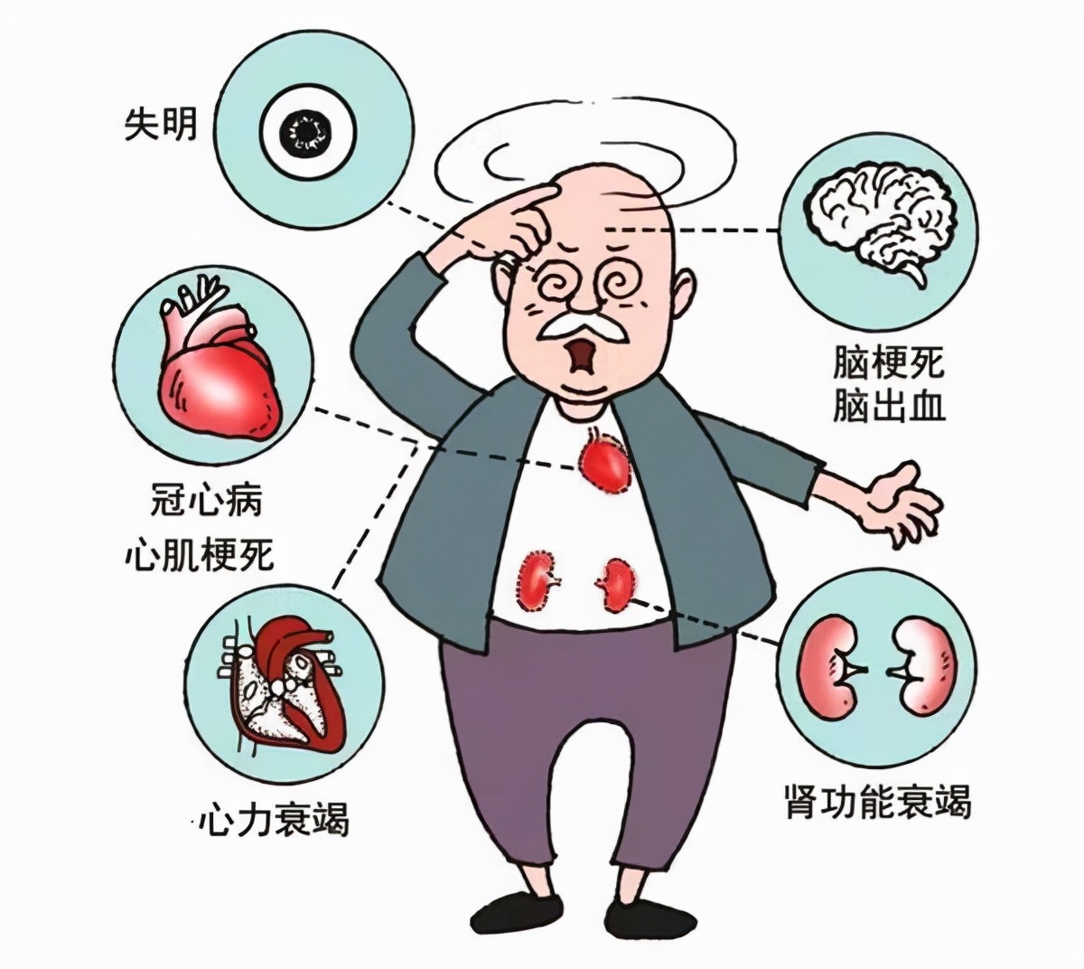 高血压140低血压90吃什么药,高血压140低血压100严重吗-友友