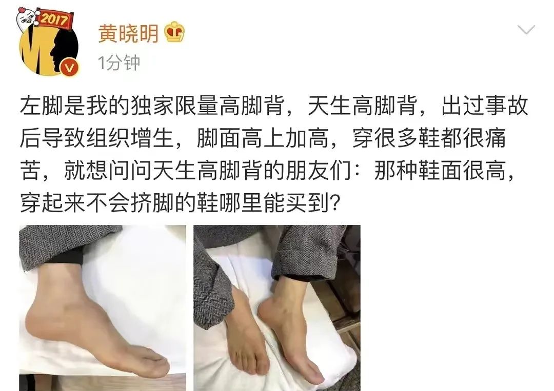 这7位明星，都因拍戏受重伤，留下“后遗症”，一个比一个严重