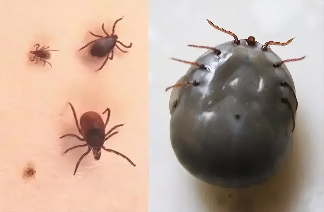 妈妈发现孩子耳廓里有粒"芝麻",看清后立马送医:还好发现得早