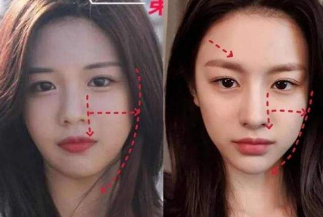 韩流明星整容堪比换头：蔡妍换脸成功，任娜英李钟硕鼻子变形