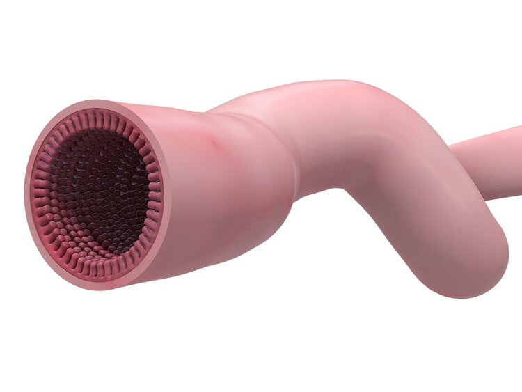 肠癌是个“傻子癌”，劝告：身体出现4个症状，高危人群及时体检