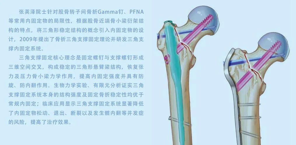 PF技术(烟台海港医院用新技术