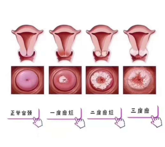 查出9种病不要害怕，一般不用手术和治疗，快来了解一下