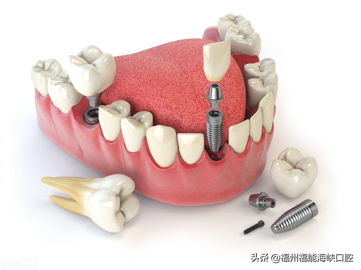 牙缝大是什么征兆？牙医：牙缝变大的主要原因、解决方法已整理好