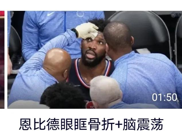 nba球员眉骨破裂有哪些（恩比德眉骨骨折加脑震荡，里弗斯该不该背责？哈登能证明自己吗？）-趣拿体育