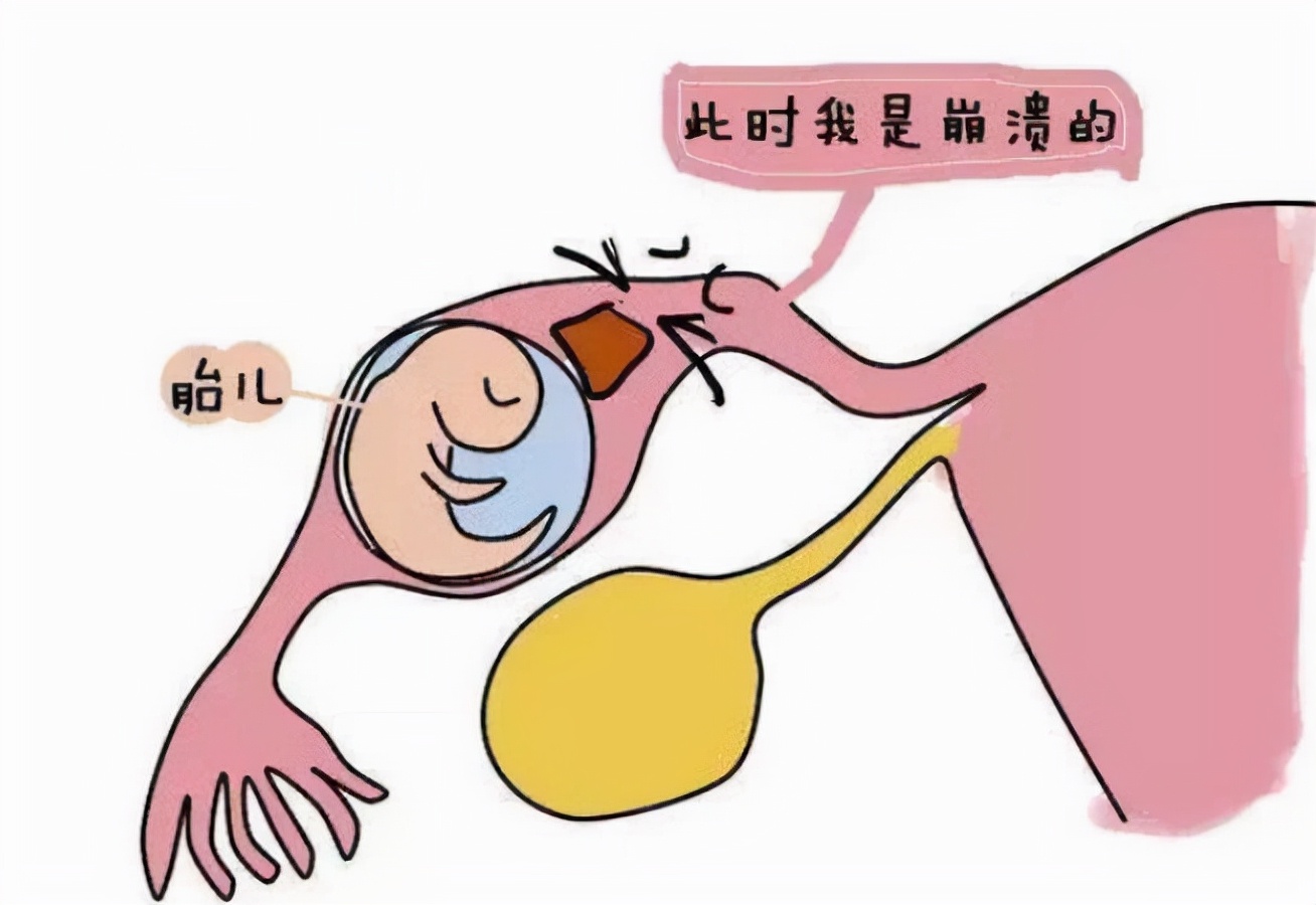 老人常说“十男九红”，孕早期见红是怀男孩的标志？孕妈别糊涂