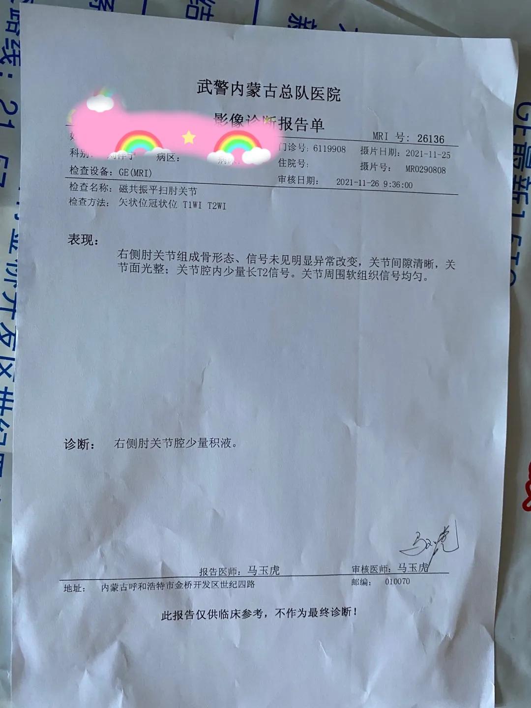 网球肘引起的手麻怎么回事(我的“网球肘”之二)