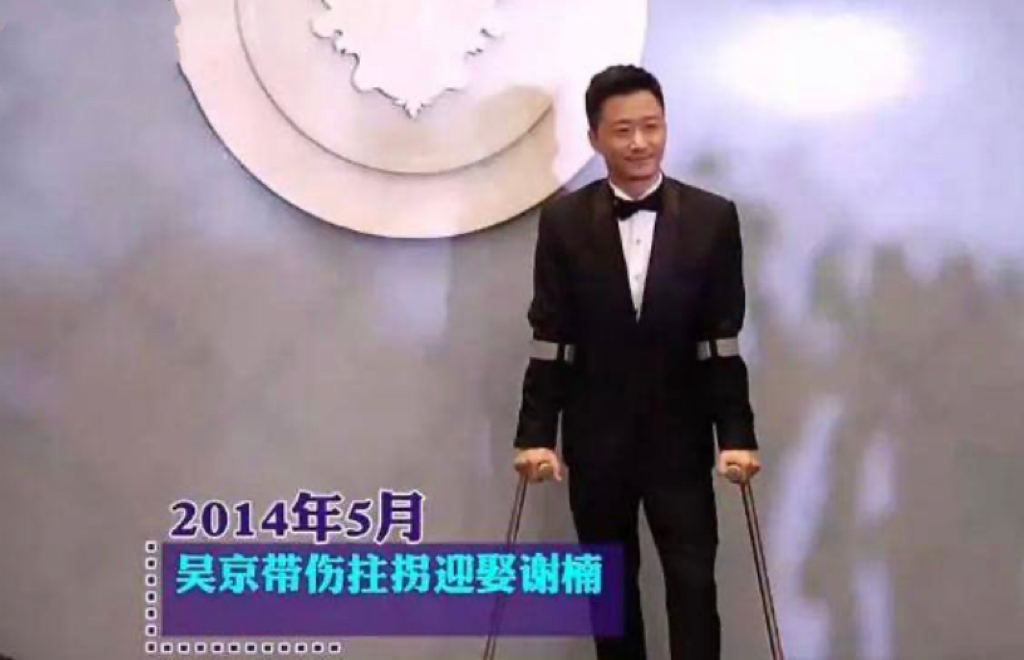 影帝影后多敬业？有人生吞12枚鸡蛋、鼻子被打歪，有人为戏锯门牙