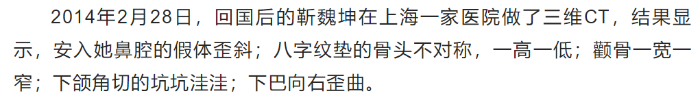 8年前，这个中国姑娘去韩国整容后，她的人生差点被毁掉