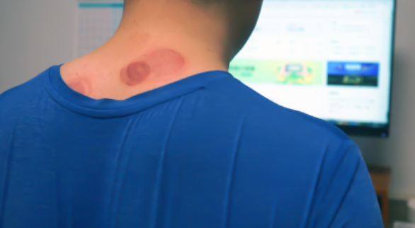 吸痧走罐，五档控温，左点智能走罐按摩器上手