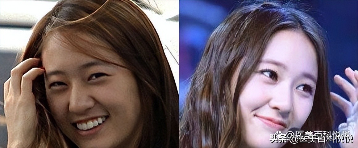 江苏苏王——你们想拥有郑秀晶同款鼻子吗