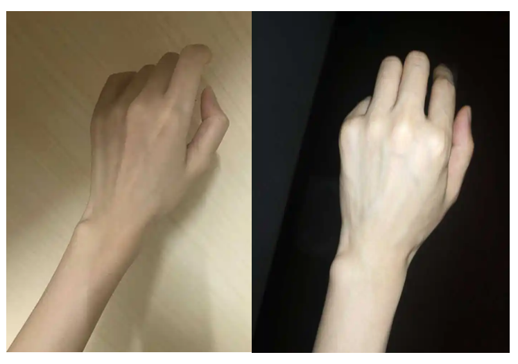 细手腕男生的痛,如何让手腕变粗?