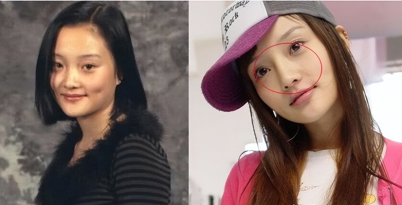 有种倔强叫"我没整容",从方脸变成瓜子脸,真当观众看不见吗?