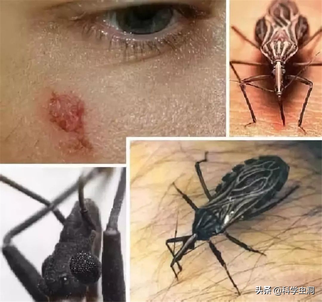 杀人最多的七种动物，第一种蚊子每年致死超72万人，你认识几种？