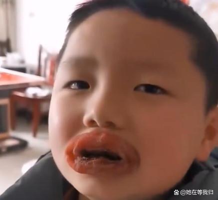 萌娃因“贪吃辣条”嘴巴肿成了香肠，孩子想哭，网友：柿饼？
