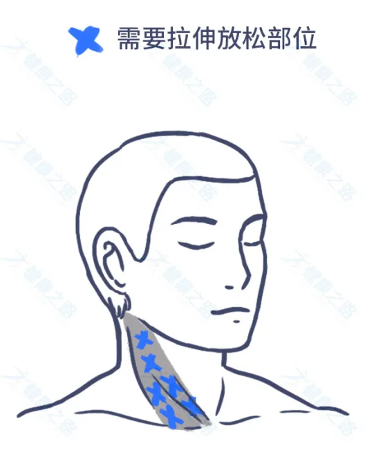 1个马上缓解头痛的方法，简单有效，还能预防颈椎病