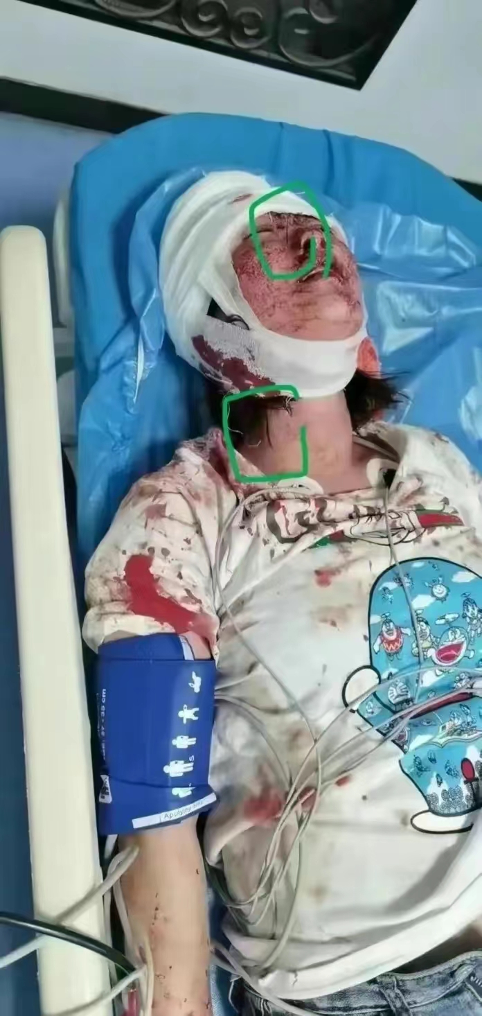 唐山最新进展：打人者牵出案中案，被打女子律师现身释放三大信号