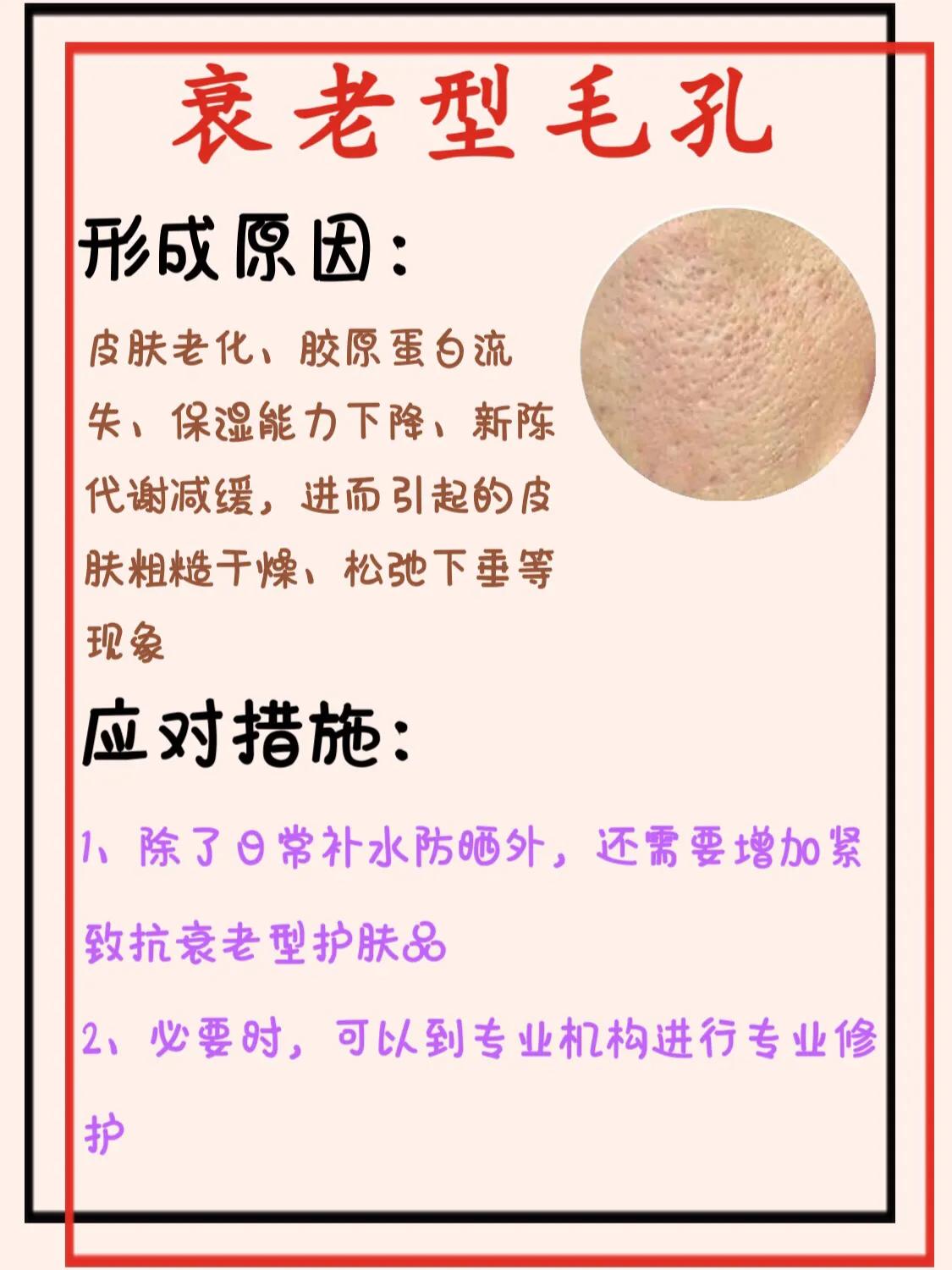 毛孔粗大四招搞定，教你低成本收缩毛孔