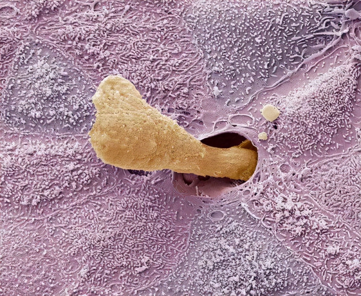 有人浑身酥麻,有人掏进医院