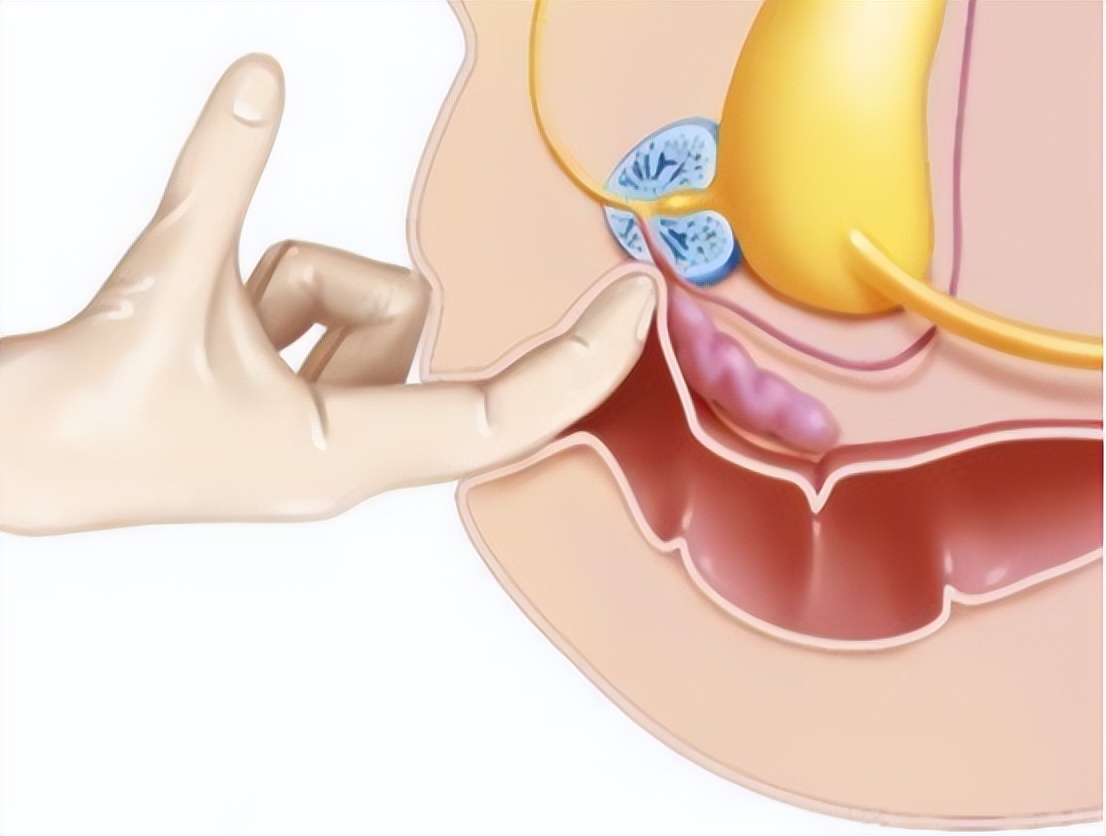 第一种膀胱湿热表现为嘘嘘出不来,一使劲就感觉疼,坚持半天挤不出小便