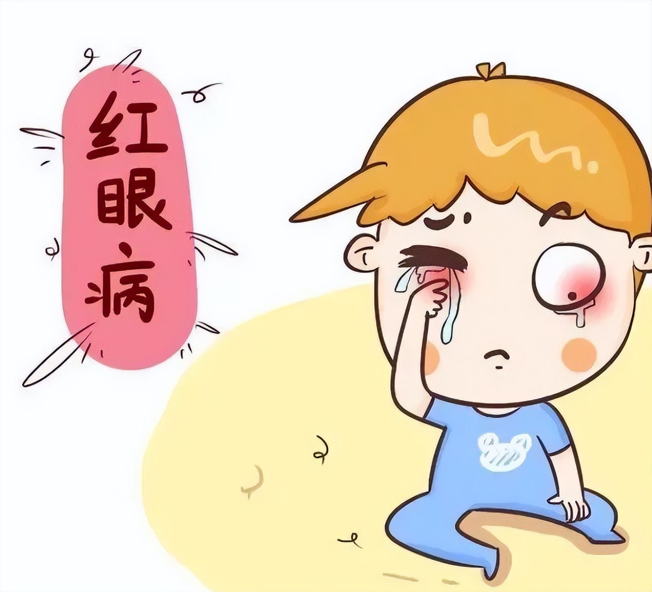 红眼病:充血,出血都是结膜看看不传染