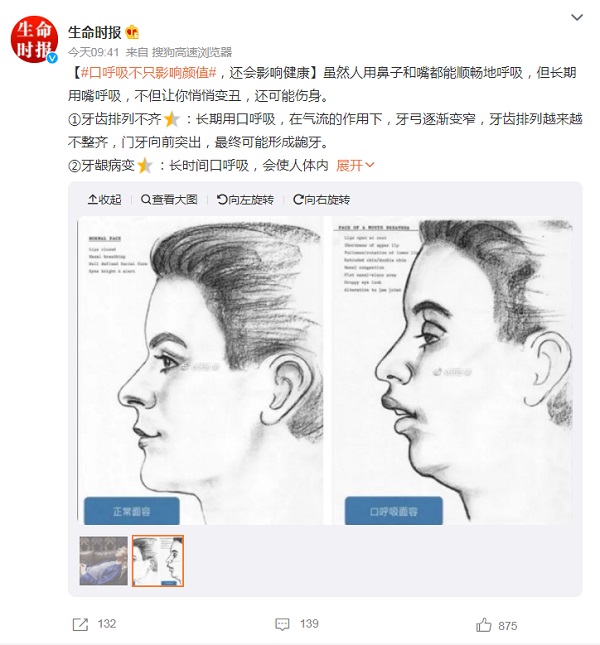 口呼吸，不只影响颜值！孩子总是张嘴睡觉，用封口贴管用吗？