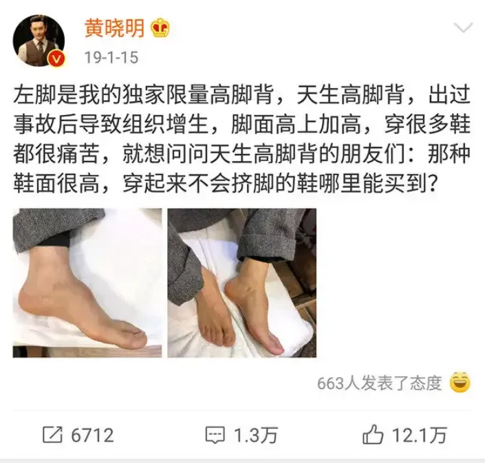 俞灏明的脸，谢霆锋的手，古天乐的眼，巨星的成功都不简单