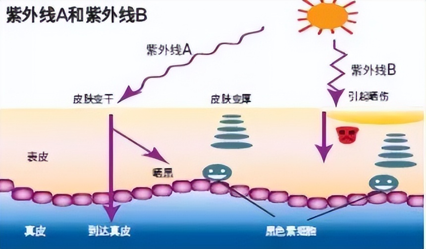 美克拉系统：皱纹为什么那么难去除，皮肤管理中心是如何除皱的