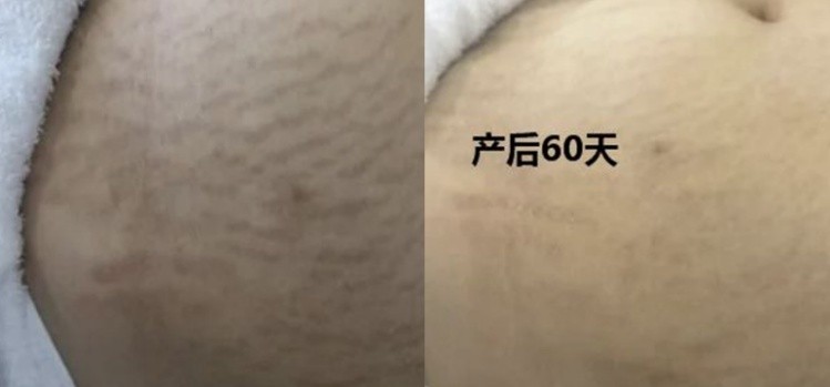 分享12件准妈必须知道的孕期好物，件件实用无鸡肋，建议孕妈收藏