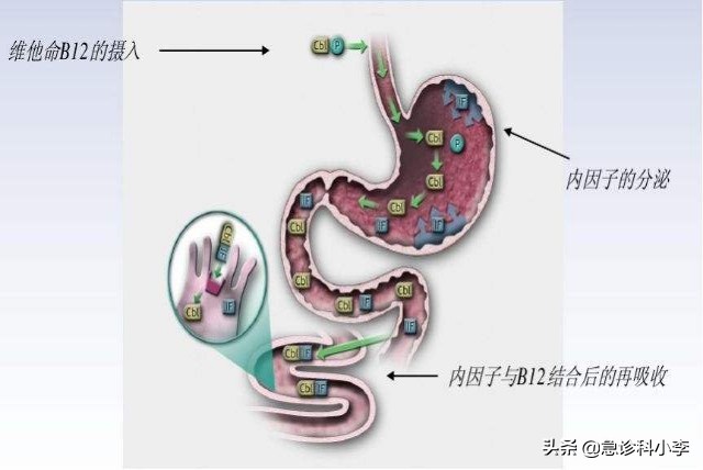 体内缺维生素B12，身体会出现哪些症状？吃什么补充？应该了解下