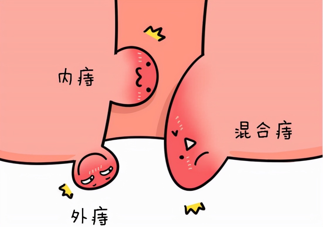 查出9种病不要害怕，一般不用手术和治疗，快来了解一下