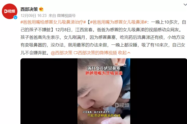 好疼！家长盲目取暖，宝宝十指溃烂：冬季护理切记这3点