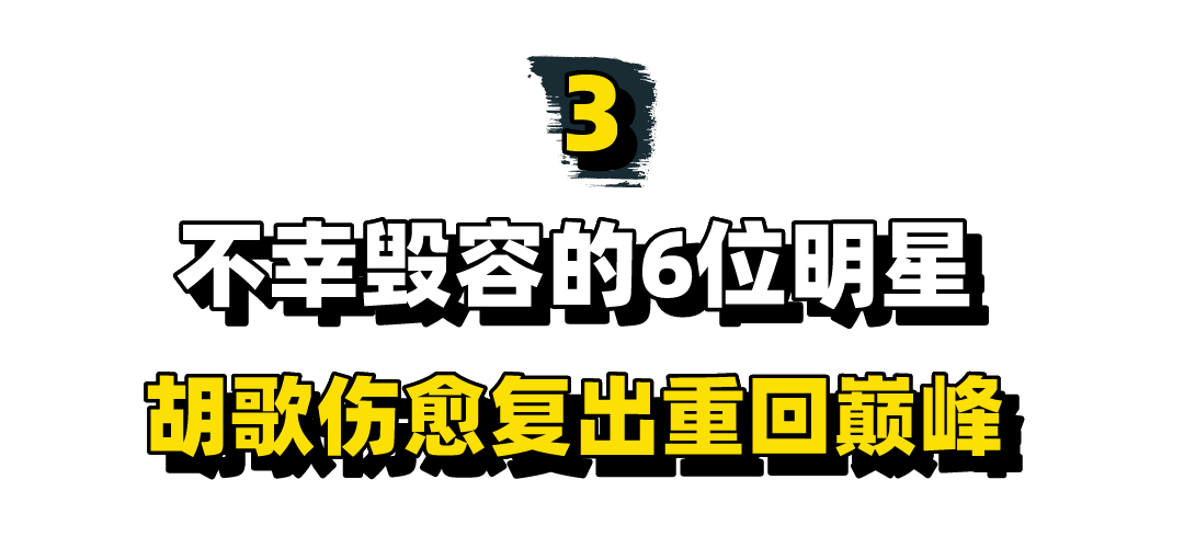 不幸毁容的6位明星：王祖贤女神变大妈，胡歌伤愈复出重回巅峰