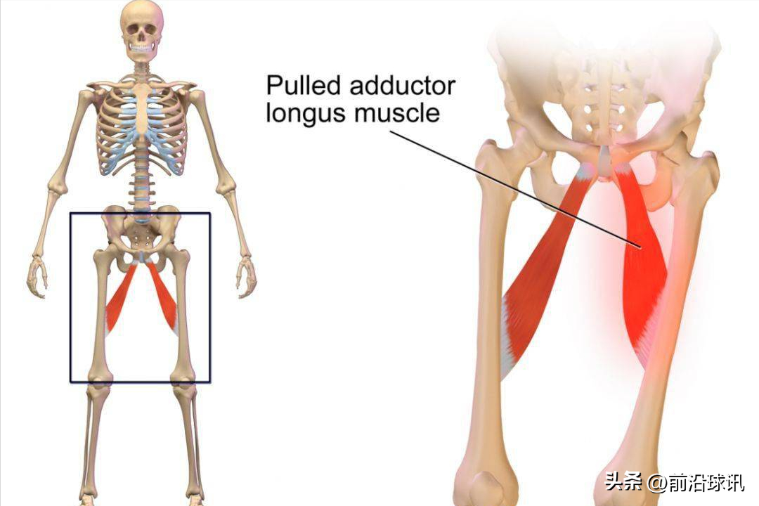 nba球员为什么易腹股沟拉伤（布克因腹股沟伤停4周，对太阳队影响多大？这个病有必要科普一下）