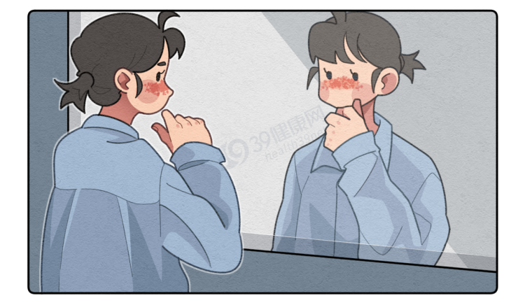 皮肤突然长红斑？当心已被“不死癌症”盯上，出现这些表现请警惕