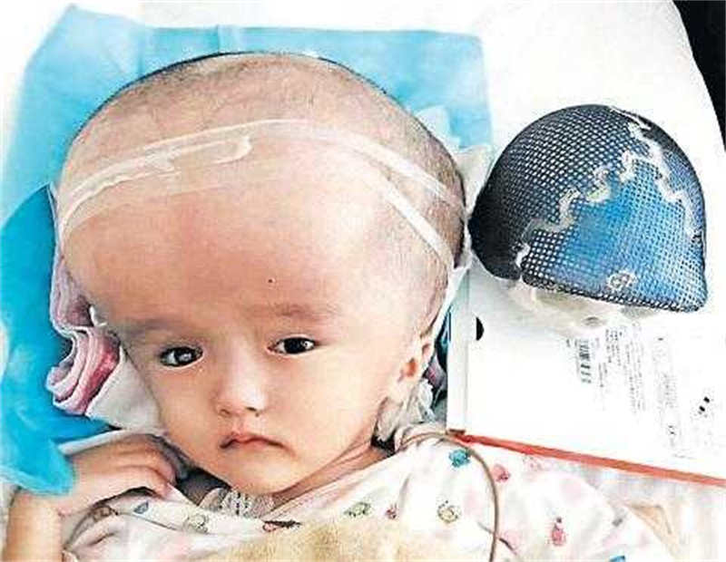 三聚氰胺事件14年，被奶粉毒害的孩子现在怎样了？透析才能活下去