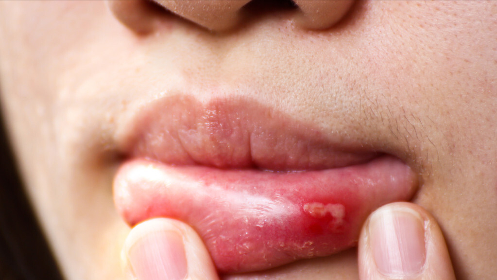 医生提醒:下半身有5种异常,当心肾炎来袭