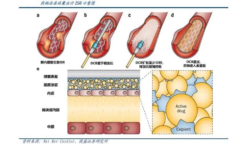 国内冠脉药物球囊第一拟IPO，知名教授创业