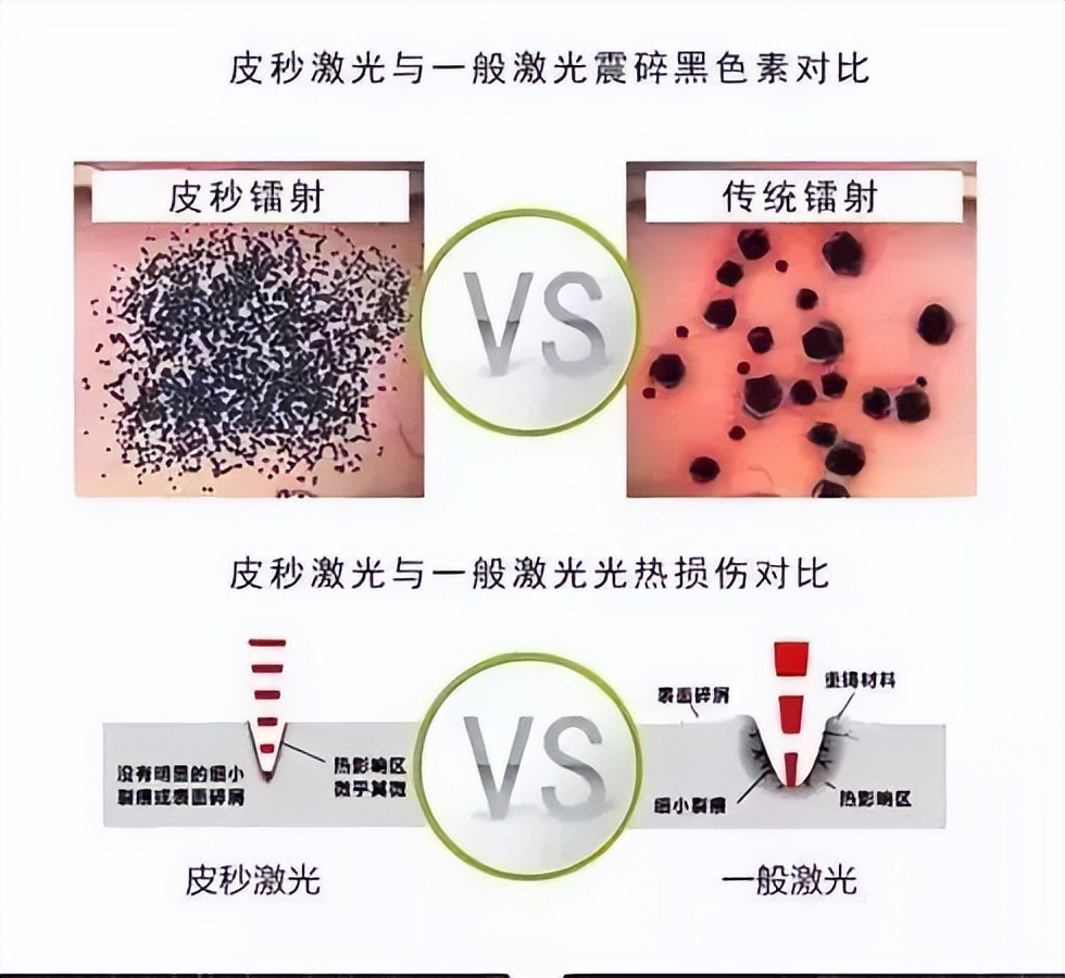 怎么樣能祛斑（別踩雷啦，真正有效的祛斑方法都在這了）