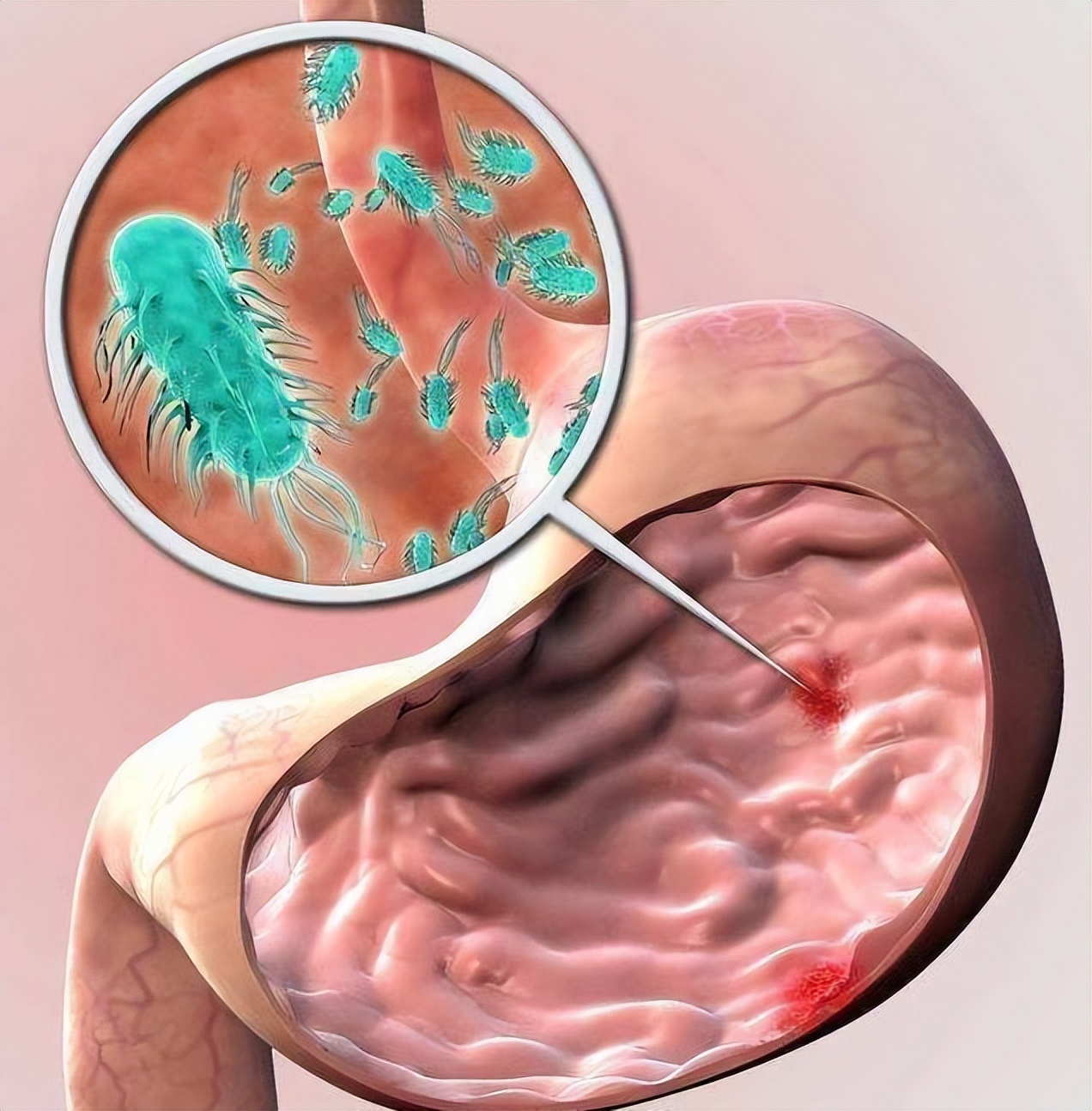 胃病是拖出来的？医生提醒：若出现“3多、2痛”，最好查下胃镜