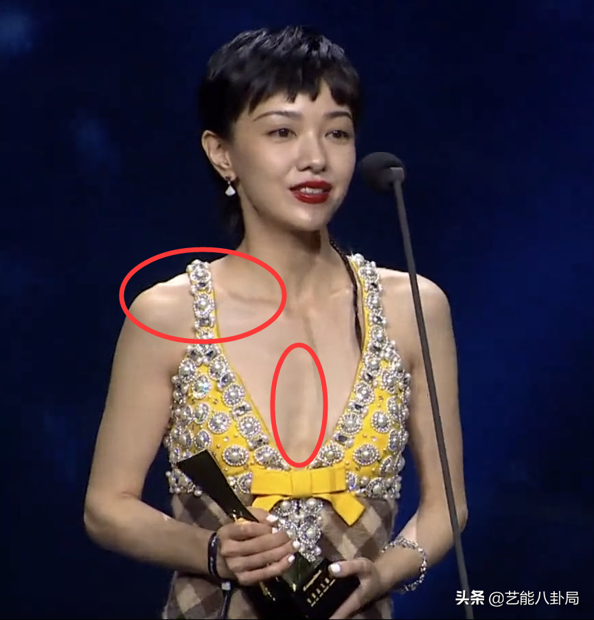 瘦脱相的10位女星:皮肉流失,行走的骷髅,瘦成纸片人真的不好看