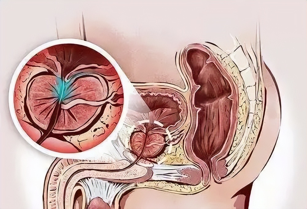 郑州看男科哪里好(「我不说，你不知道」郑州大学二附院治疗前列腺有妙招)
