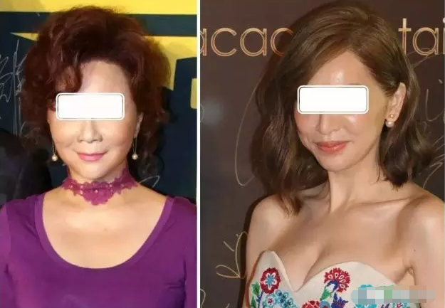 瘦到病态，动脸成瘾，切胃、剪肠齐上阵，内娱的畸形审美真可怕