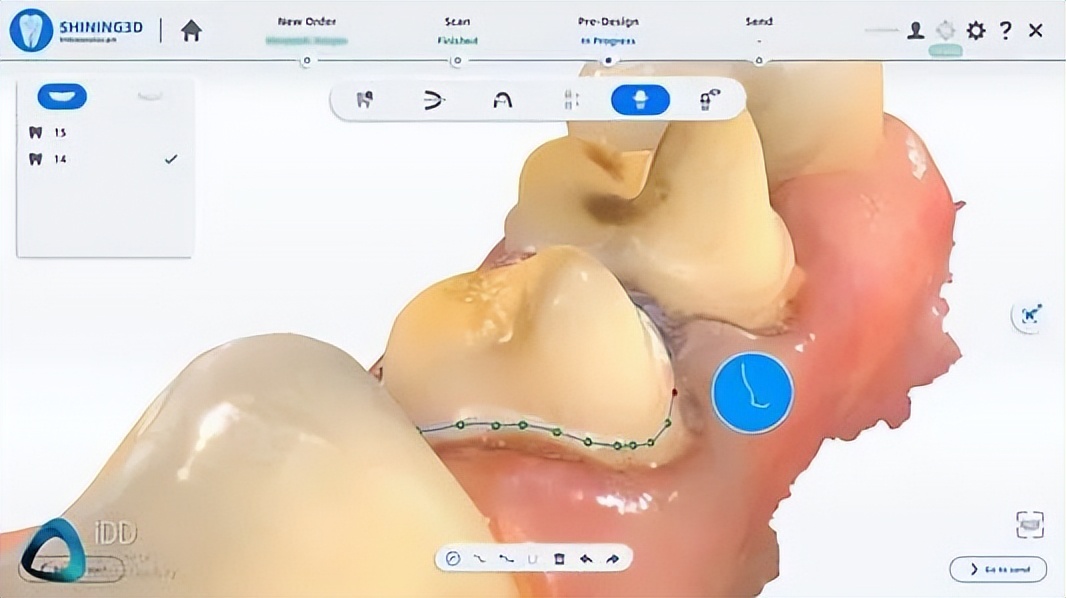 Aoralscan 3软硬件性能强劲，值得入手