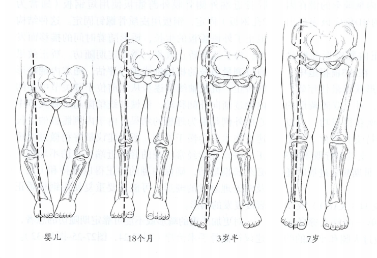 焦虑！宝宝O形腿与X形腿，也许只是妈妈需要“话聊”。